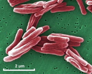 mycobacterium20tuberculosis20030
